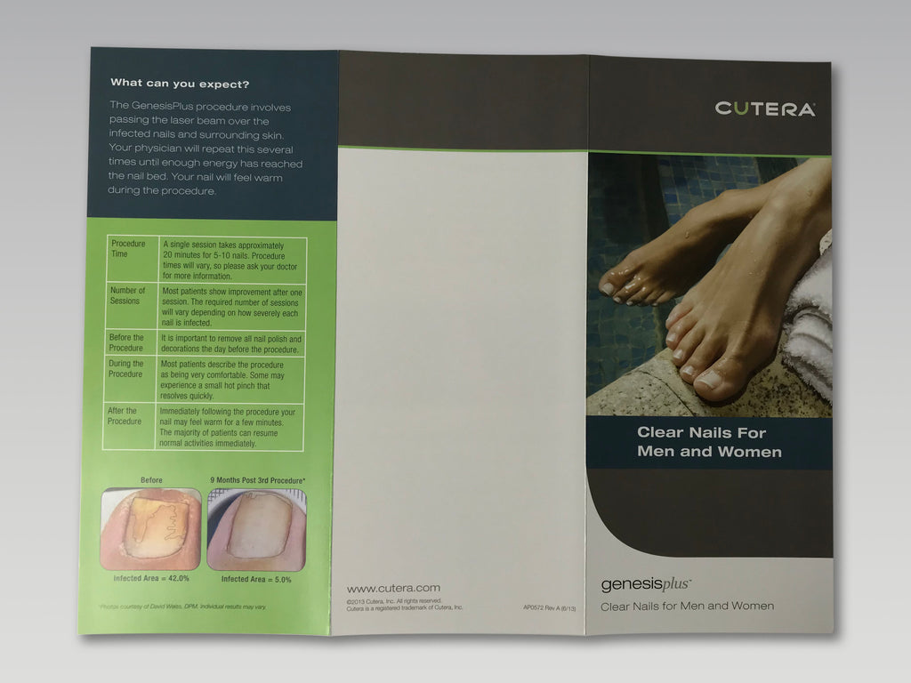 Cutera Genesis Plus Nd YAG GenesisPlus Nail Fungus Treatment Patient Brochures