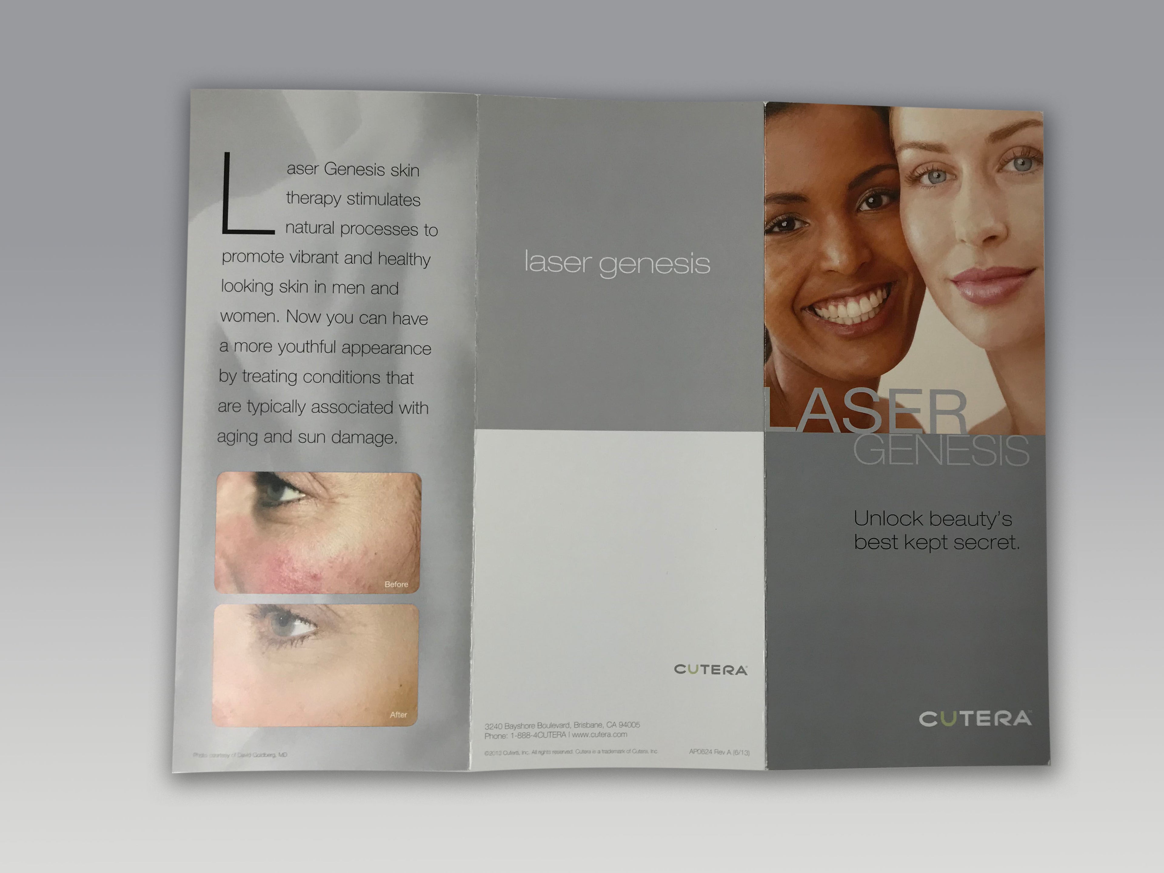 Cutera Laser Genesis Fine Wrinkle Redness Scars Skin Therapy Patient Brochure