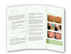 Cutera Laser Genesis Limelight Titan 3D Revitalize Therapy Patient Brochure 25pk