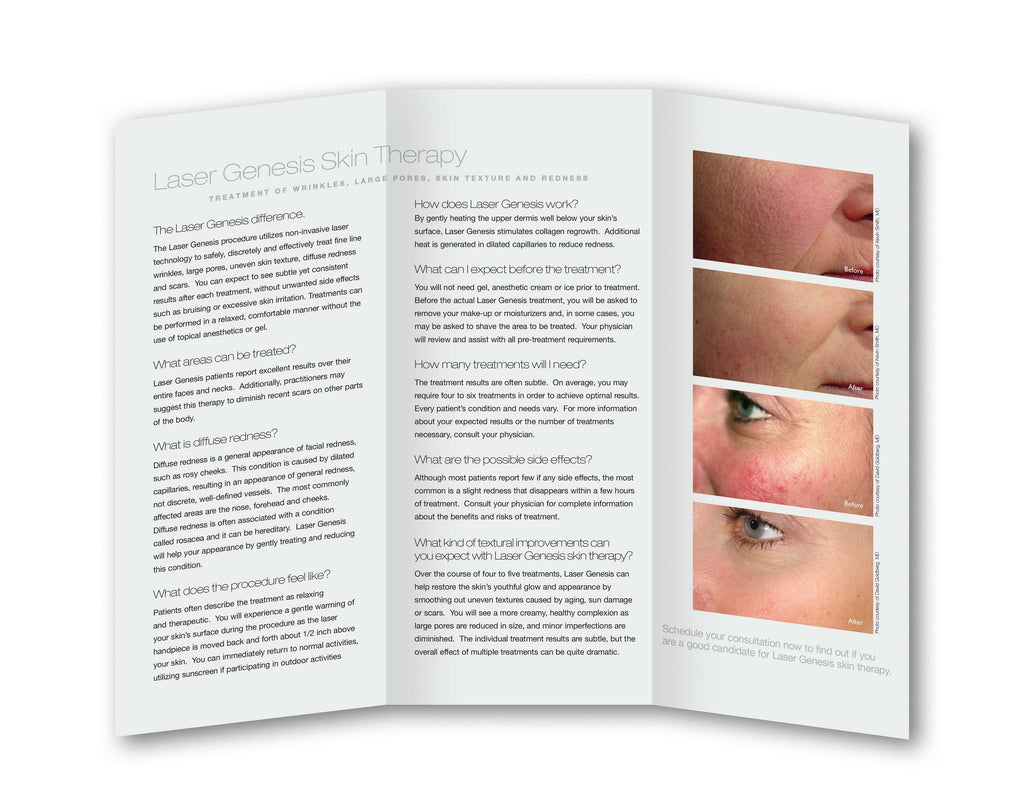 Cutera Laser Genesis Skin Revitalization Wrinkles Pores Redness Brochures 25Pack