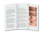 Cutera Laser Genesis Skin Revitalization Wrinkles Pores Redness Brochures 25Pack