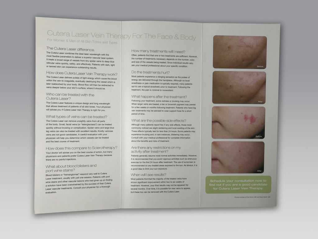 Cutera Lasers Leg Vein Therapy Face and Body Laser Treatment Patient Brochures
