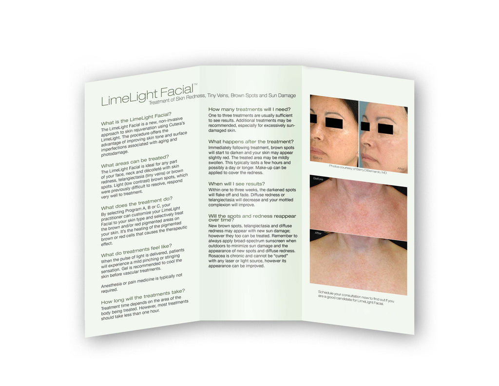 Cutera LimeLight IPL Facial Skin Rejuvenation Pigmentation Vein Brochures 25/pck