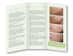 Cutera XEO Laser Vascular Vein Removal Telangiectasia Patient Brochures 25 Pack