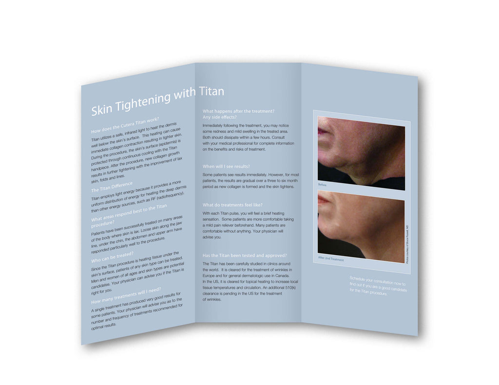 Cutera XEO Titan IPL Skin Tightening Wrinkle Reduction Patient Brochures 25 Pack