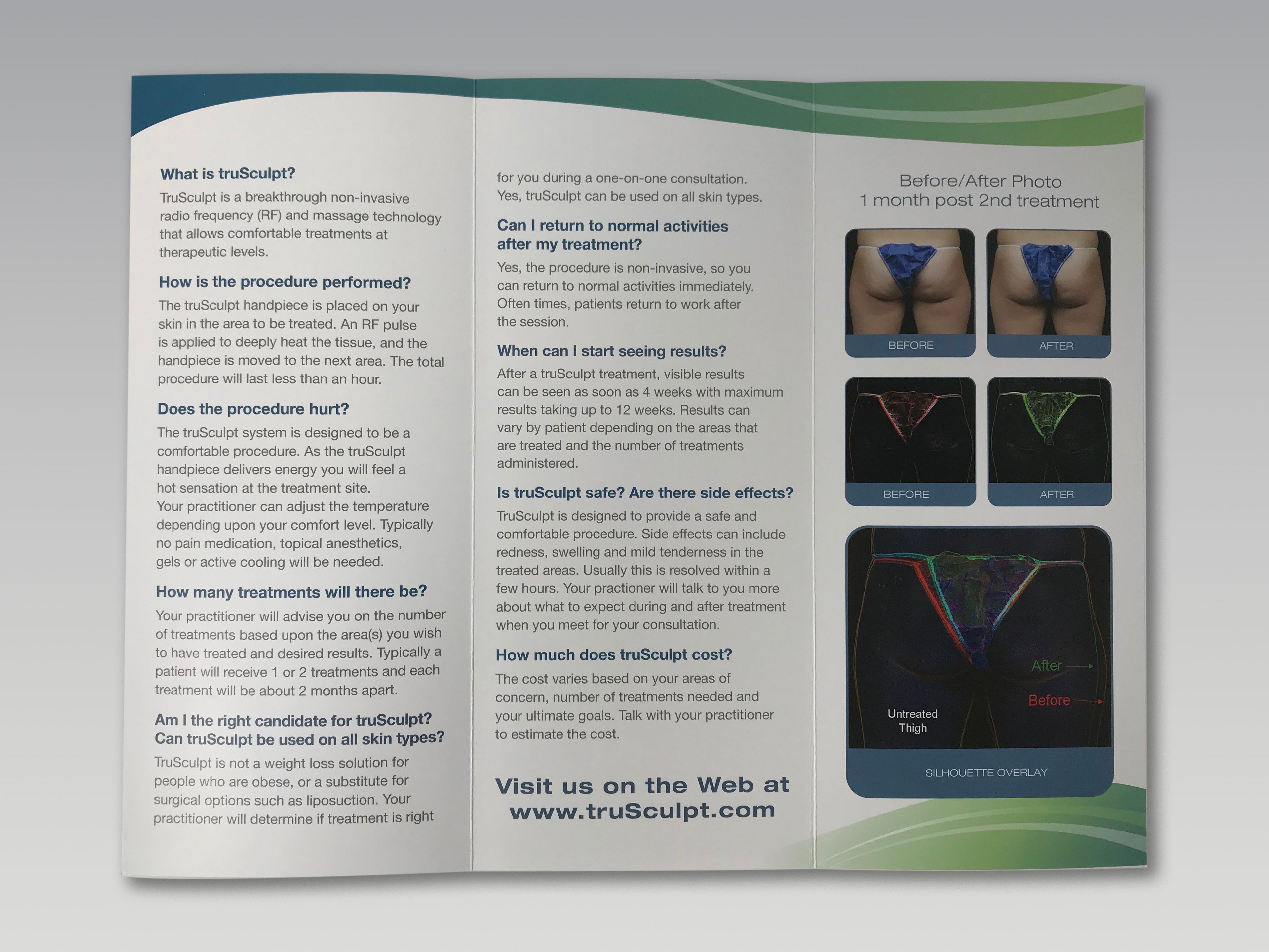 Cutera truSculpt RF Body Contouring True Sculpt Treatment Patient Brochure 25 Lot