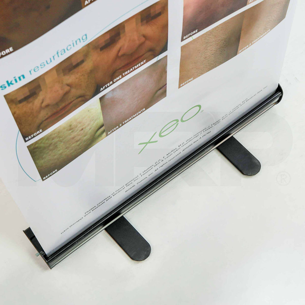 Cutera Xeo "Let Your Skin Blossom With Confidence" Banner Stand