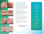 CynoSure Elite Laser Skin Revitalization Marketing Tri Fold Brochures Pamphlets