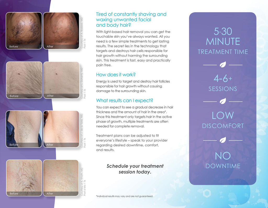 Cynosure Elite Laser Hair Removal Patient Marketing Brochure Pamphlets 100 Pack