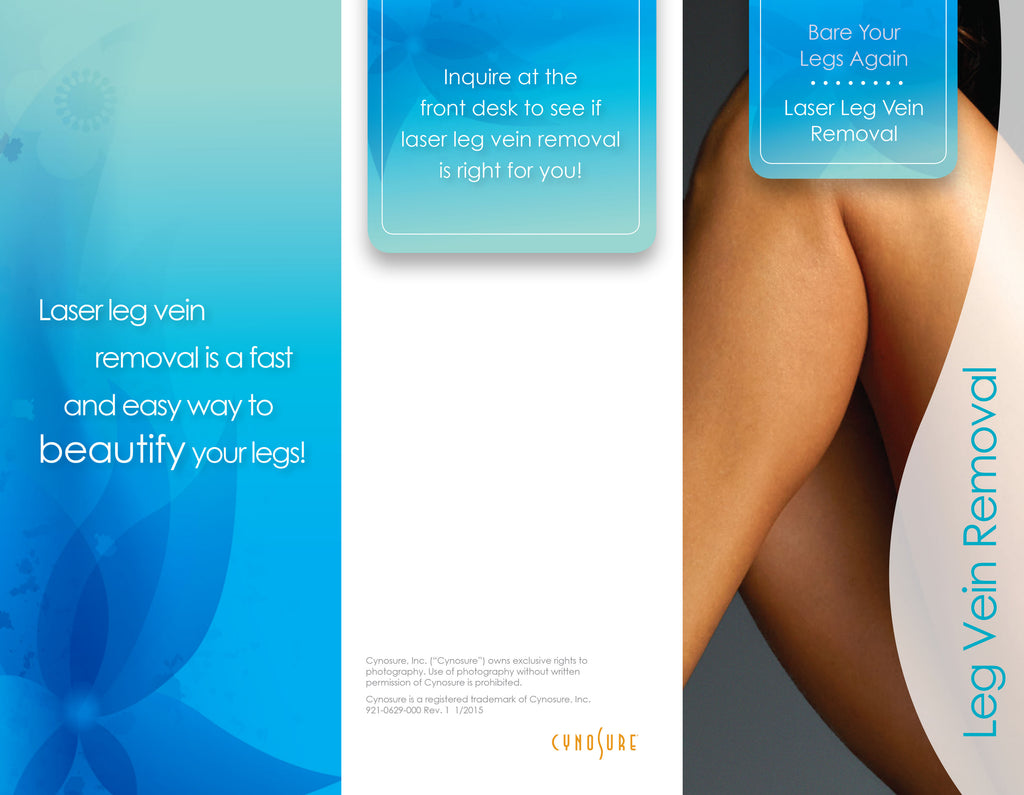 Cynosure Elite Laser Leg Vein Removal Patient Marketing Brochure Pamphlet 100pc