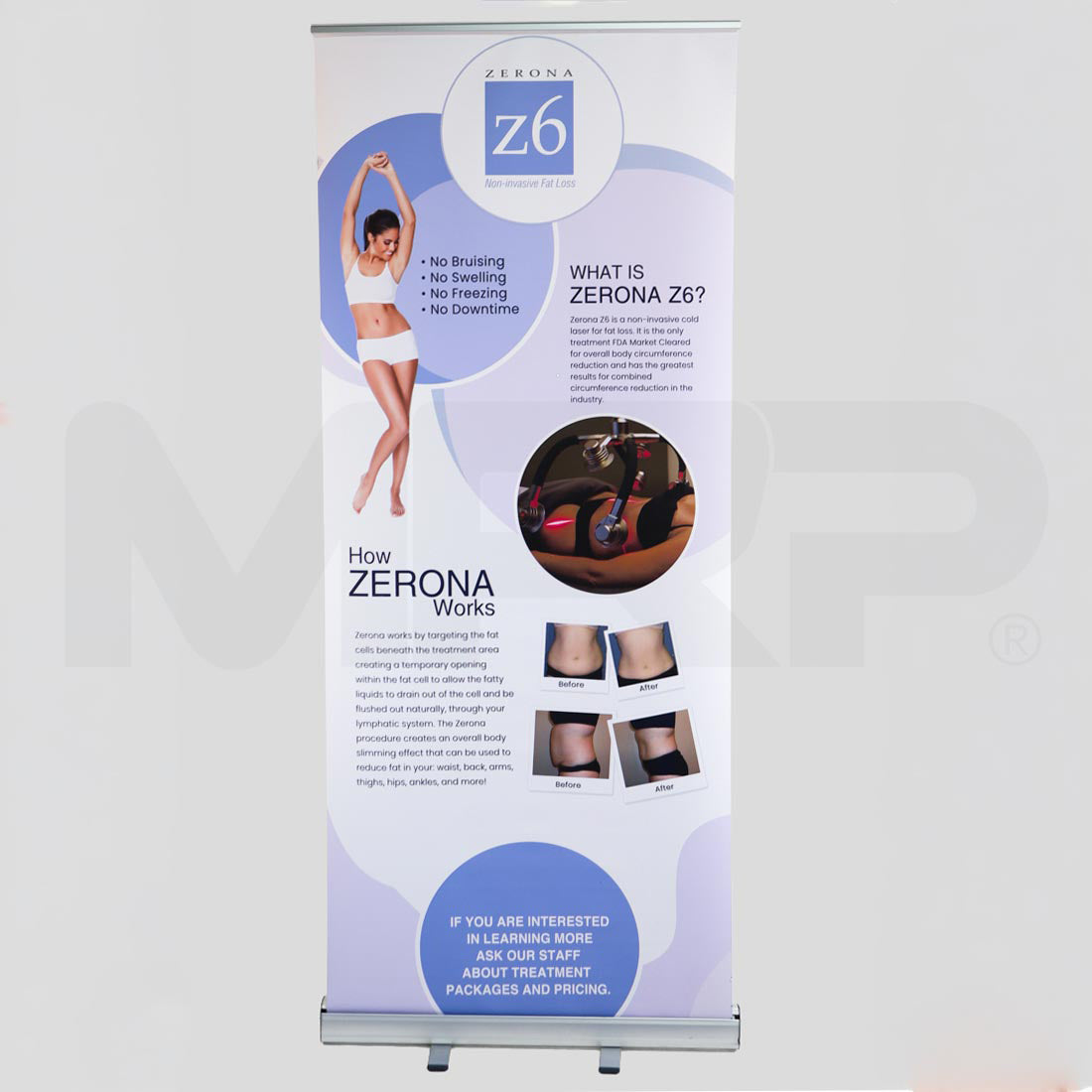 Erchonia Zerona Z6 Non-Invasive Fat Loss Marketing Display Banner