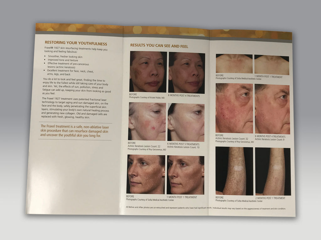 Fraxel 1927 Fractional Skin Resurfacing Laser Pigment Aging Patient Brochures