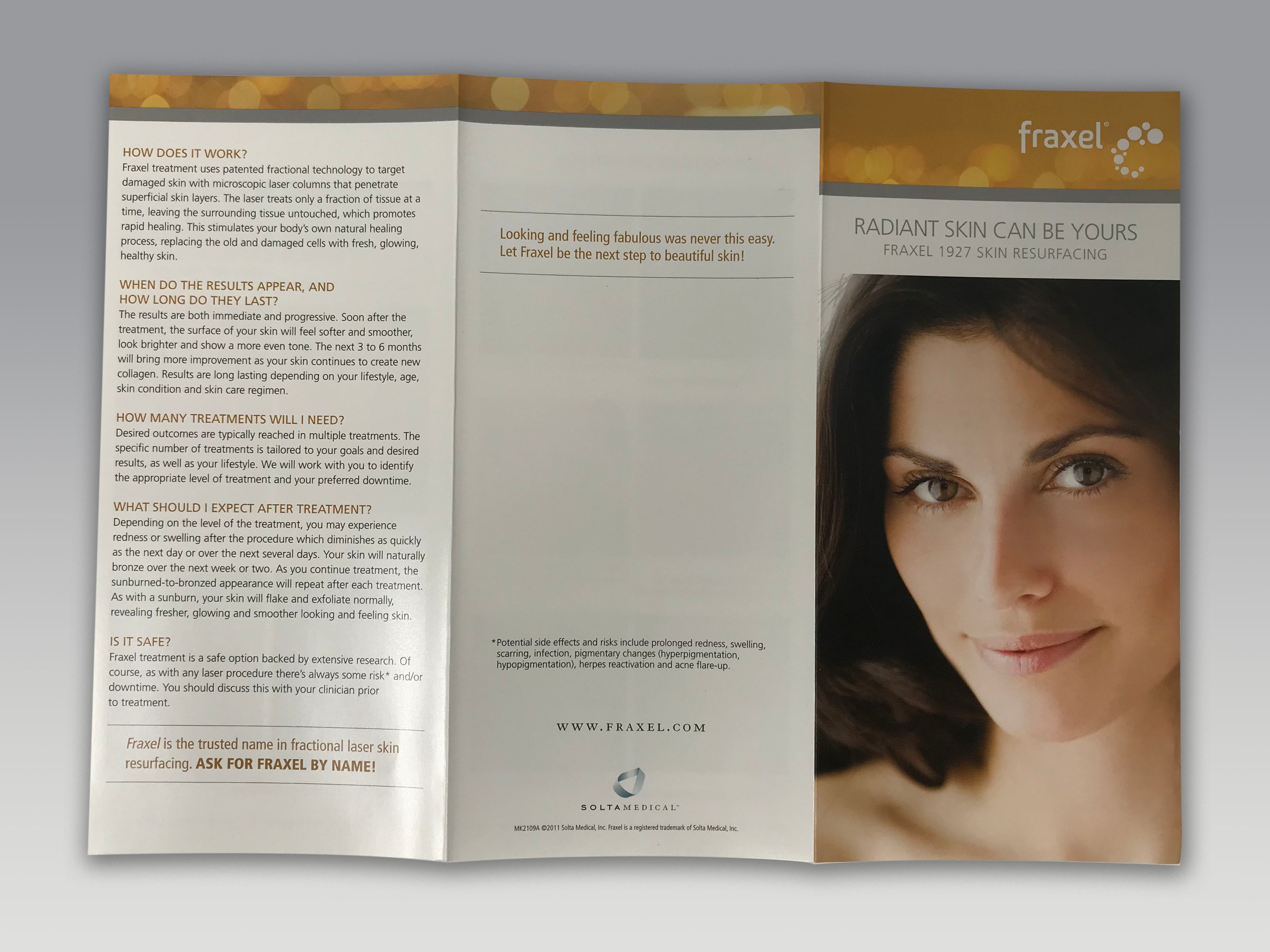 Fraxel 1927 Fractional Skin Resurfacing Laser Pigment Aging Patient Brochures