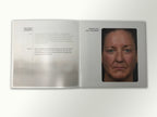 Fraxel Dual 1550 1927 Patient Diary Before & After Progress B&A Brochure Booklet