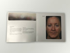 Fraxel Dual 1550 1927 Patient Diary Before & After Progress B&A Brochure Booklet