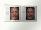 Fraxel Dual 1550 1927 Patient Diary Before & After Progress B&A Brochure Booklet