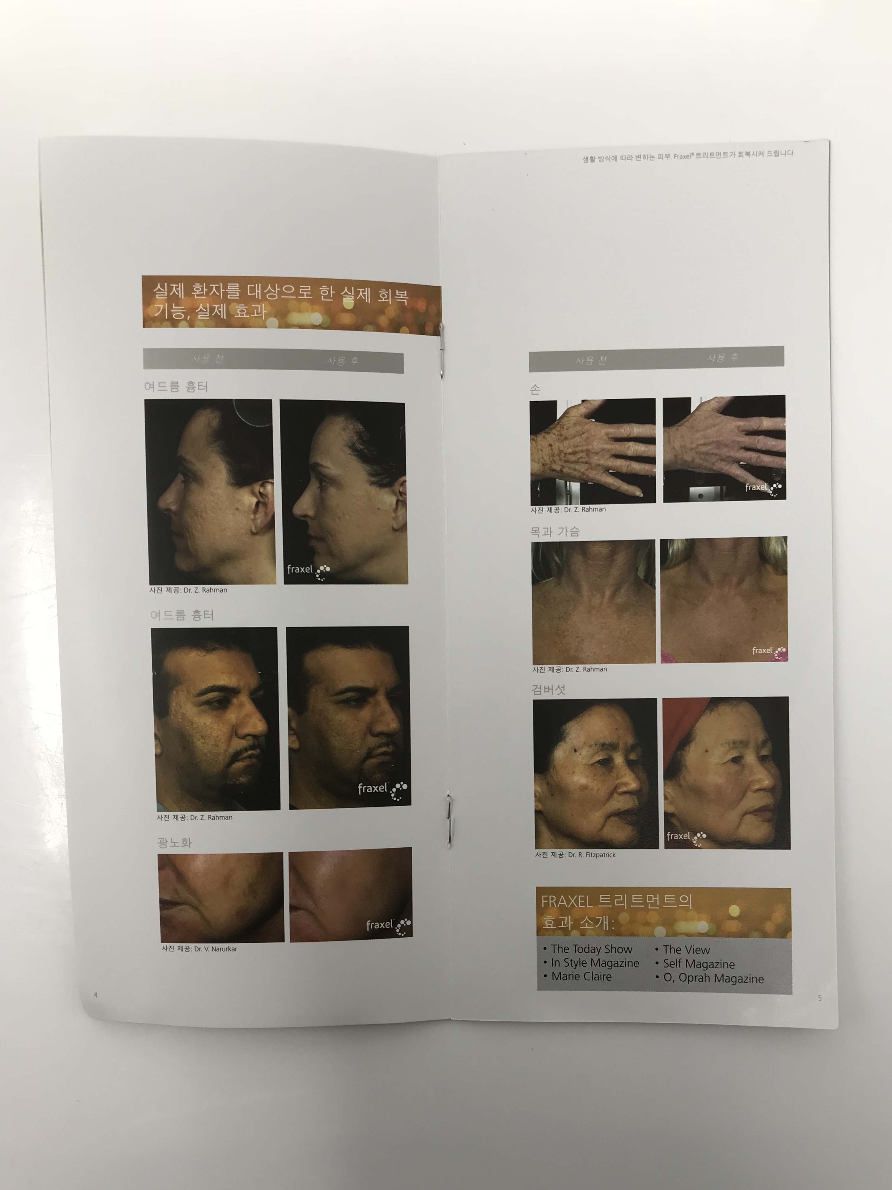 Fraxel Fractional Skin Rejuvenation Laser Korean Patient Brochures Pack of 22