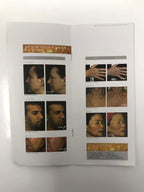Fraxel Fractional Skin Resurfacing Rejuvenation Laser Korean Patient Brochures