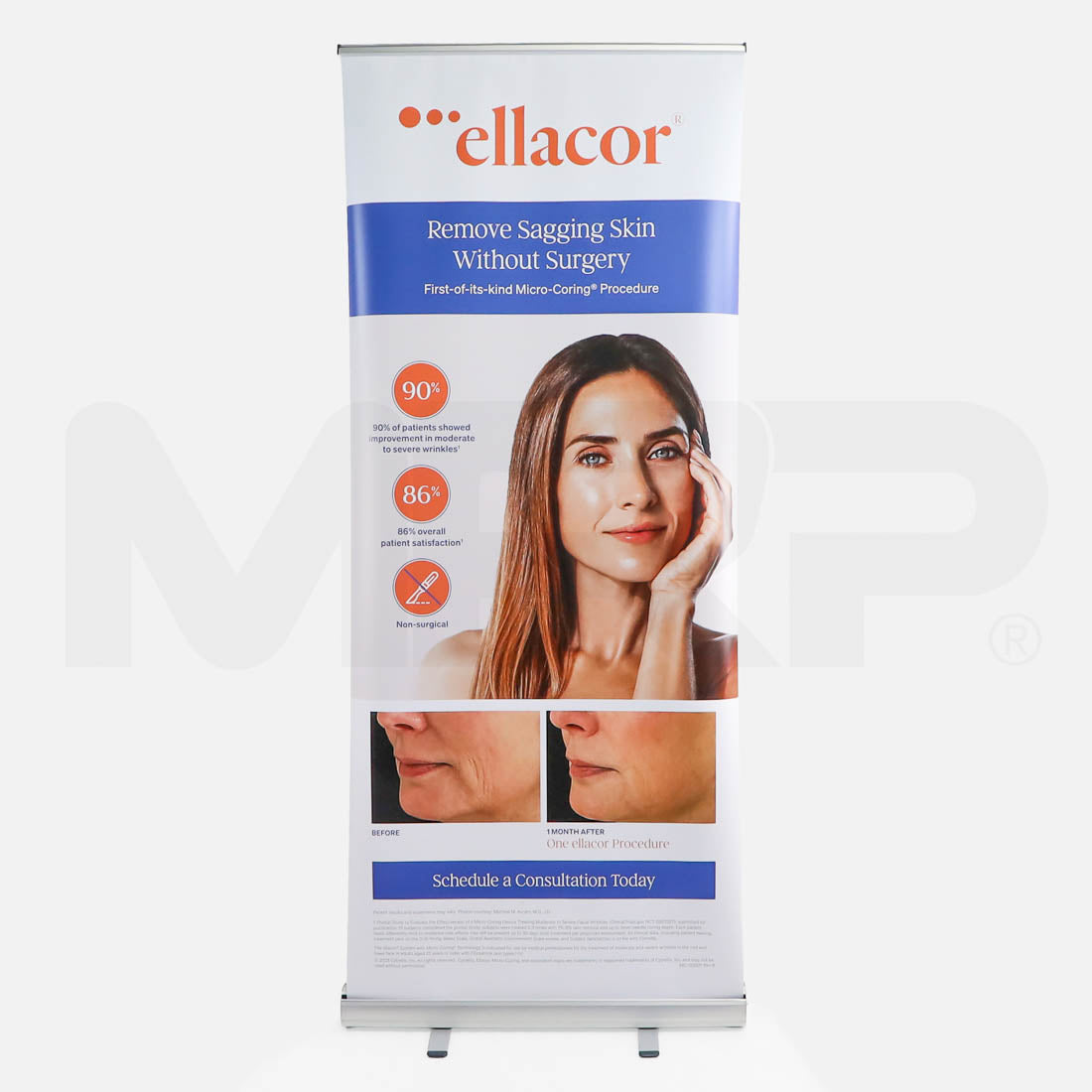 Cytrellis Ellacor Remove Sagging Skin Without Surgery Retractable Marketing Banner