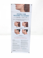 Kybella Chin Injection 32” x 80” Vinyl Patient Information Banner W/ Stand