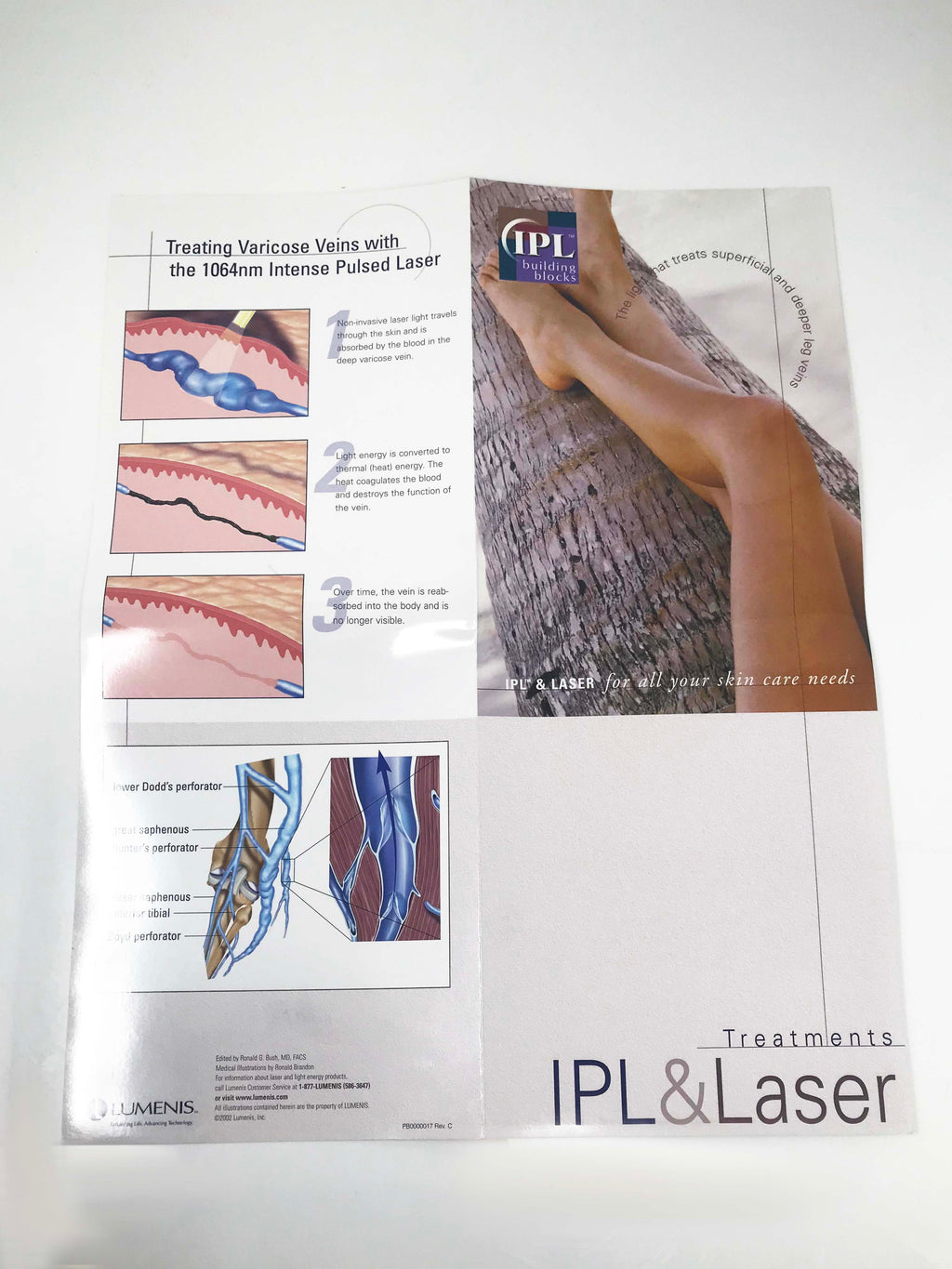 LUMENIS IPL laser Vascular 1064 Varicose Leg Vein Treatments Illustrative Poster