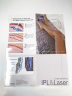 LUMENIS IPL laser Vascular 1064 Varicose Leg Vein Treatments Illustrative Poster