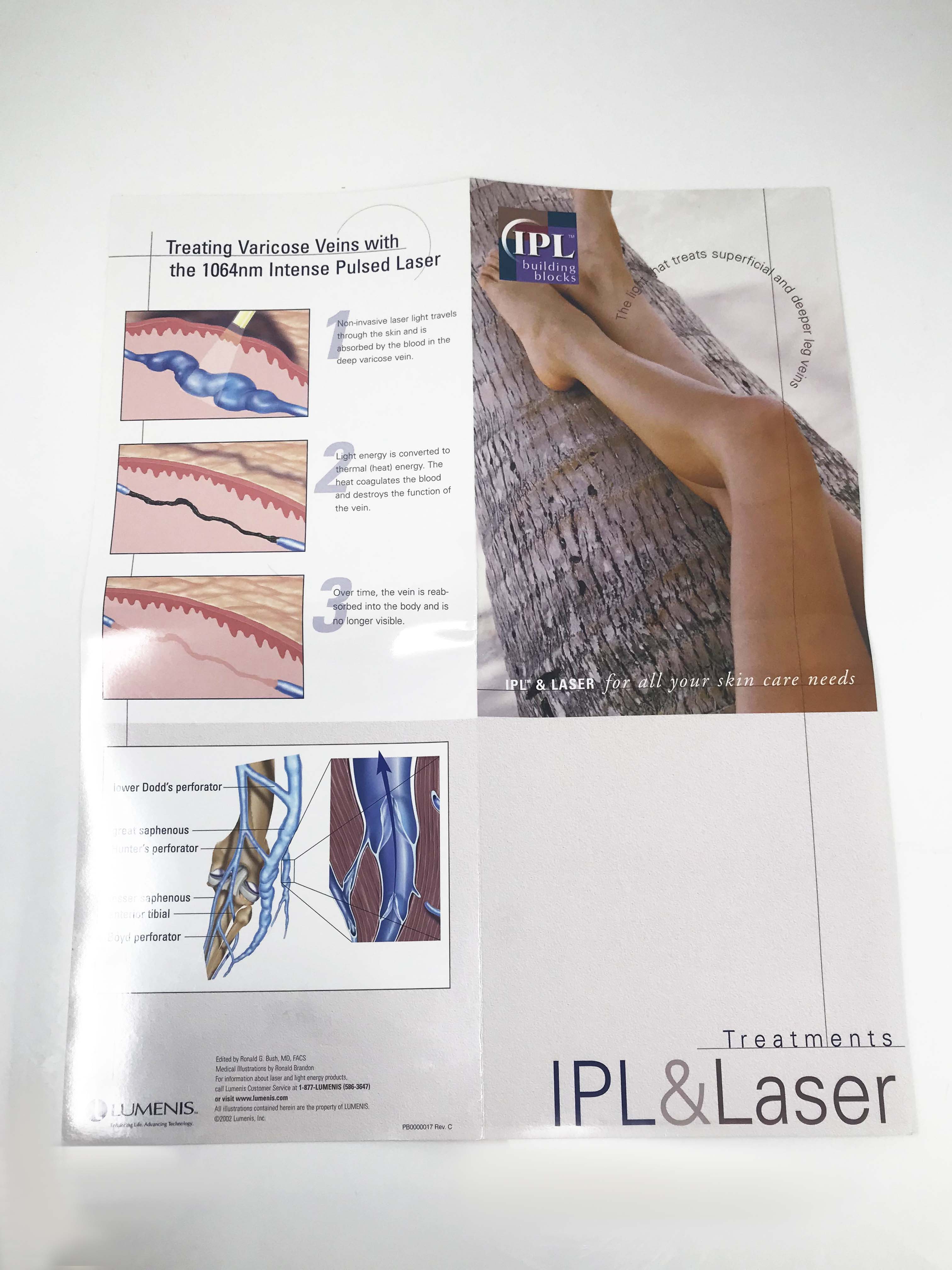 LUMENIS IPL laser Vascular 1064 Varicose Leg Vein Treatments Illustrative Poster