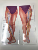 LUMENIS IPL laser Vascular 1064 Varicose Leg Vein Treatments Illustrative Poster