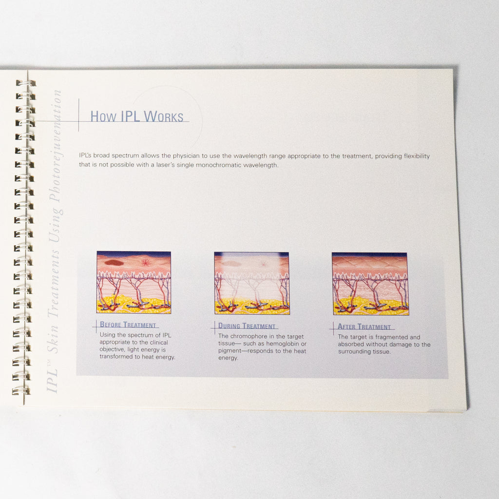 Lumenis IPl Qauntum Clinical Casebook IPL Skin Treatments Patient information