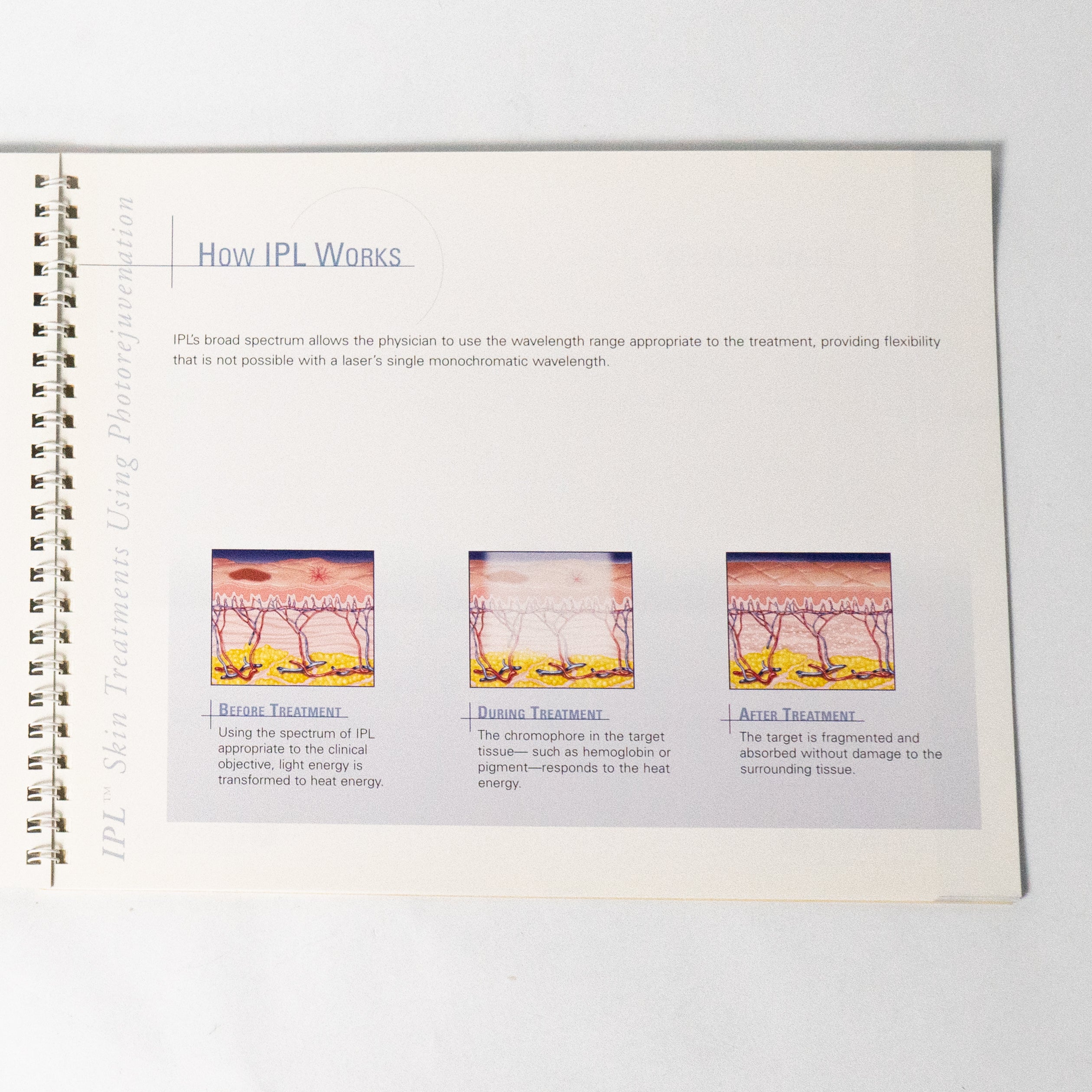 Lumenis IPl Qauntum Clinical Casebook IPL Skin Treatments Patient information