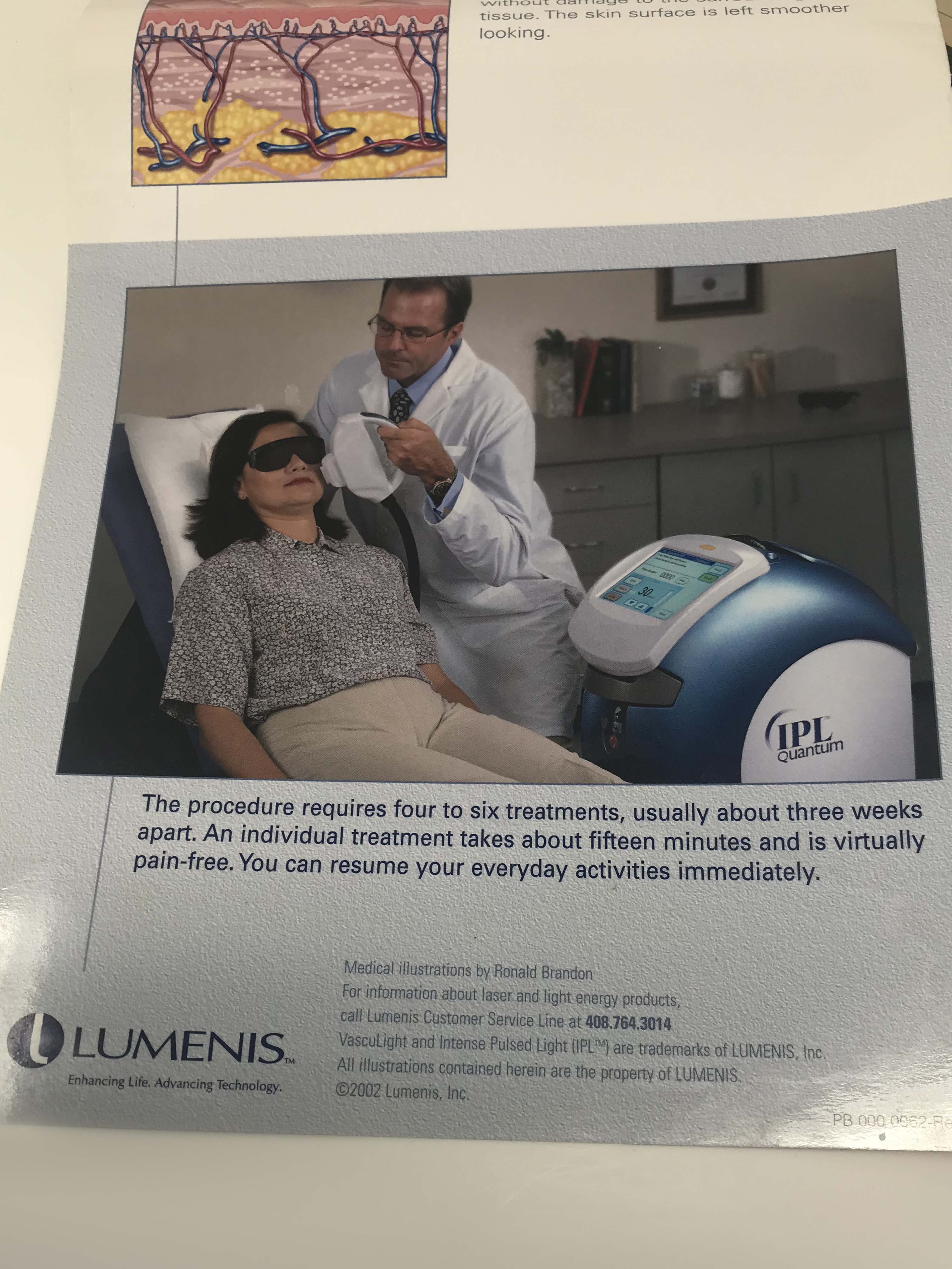 LUMENIS Quantum Laser IPL Aesthetic Skin Photo Rejuvenation Illustrative Poster