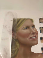 LUMENIS Quantum Laser IPL Aesthetic Skin Photo Rejuvenation Illustrative Poster