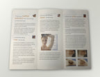 Lumenis LightSheer Diode Laser Hair Removal Light Sheer Patient Brochures