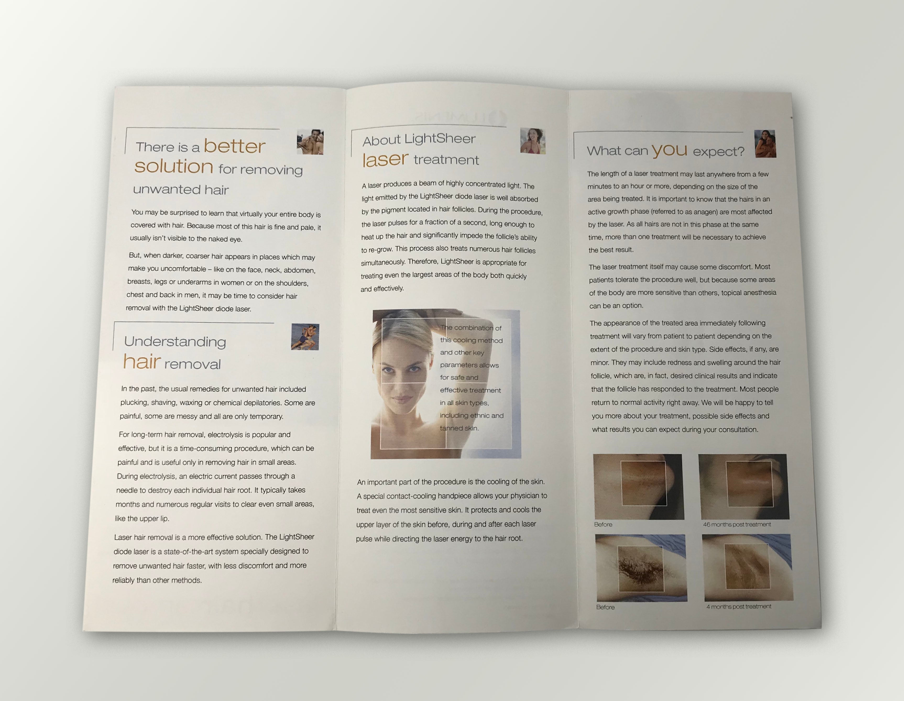 Lumenis LightSheer Diode Laser Hair Removal Light Sheer Patient Brochures