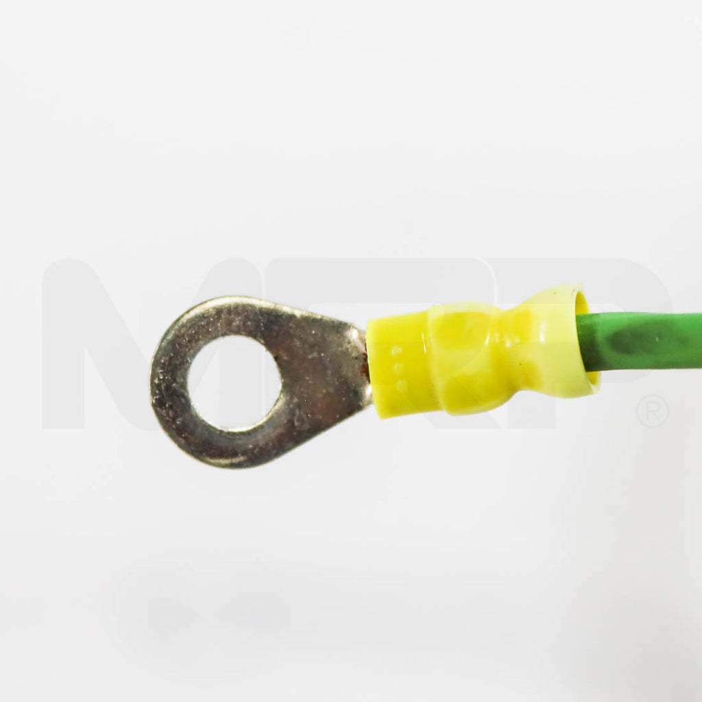 Lumenis UltraPulse Power Cord Connector Loop