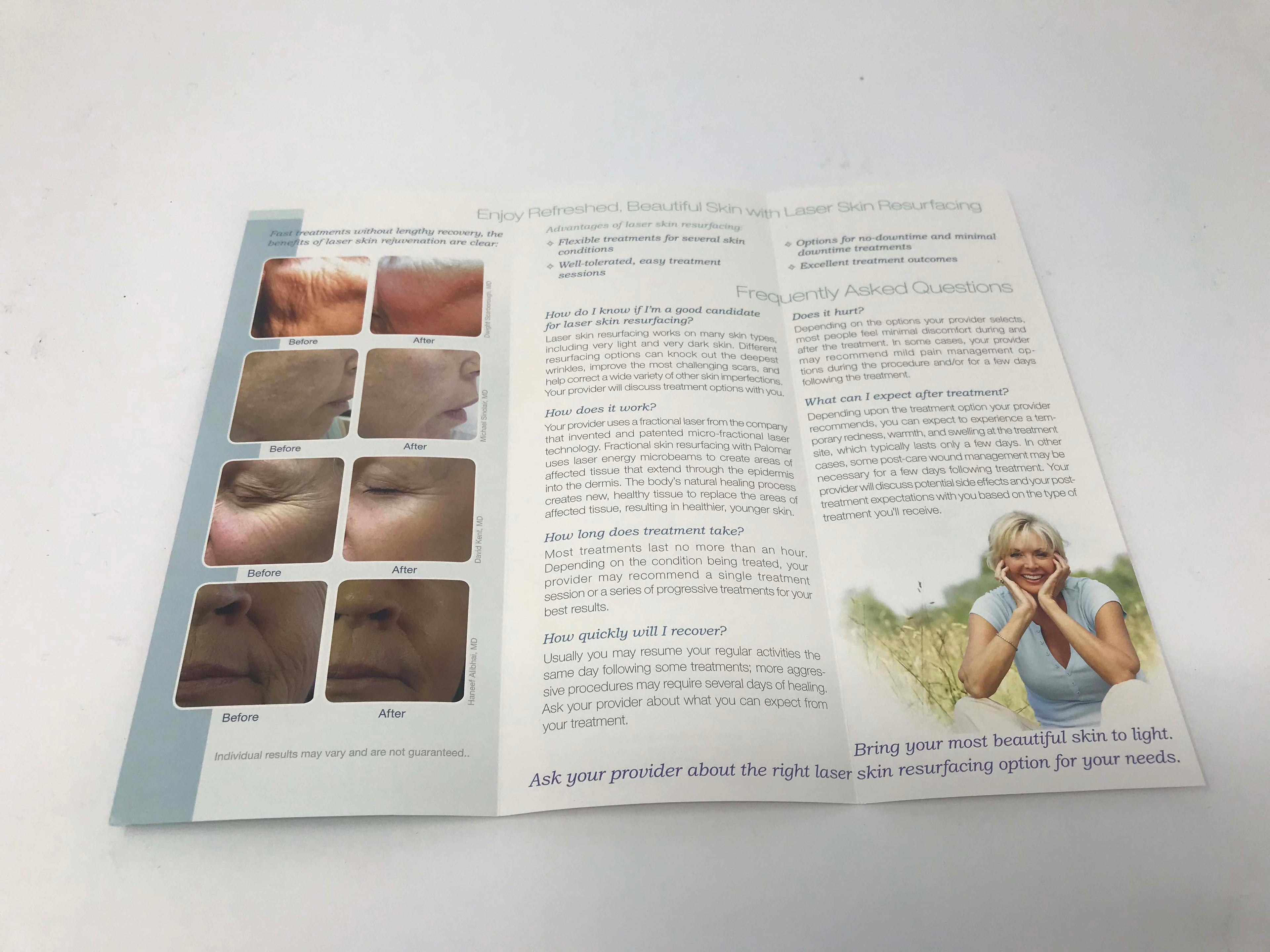 Palomar Fractional Laser Facial Skin Resurfacing Wrinkle Scar Patient Brochures
