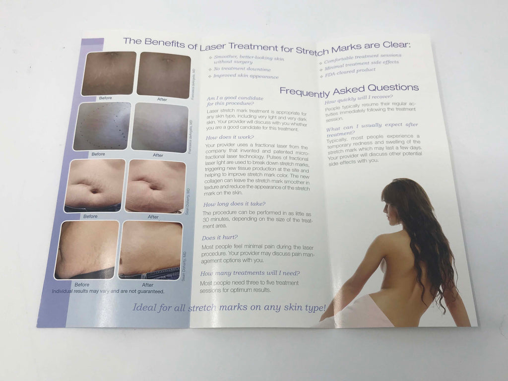 Palomar Fractional Laser Skin Resurfacing Stretch Mark Removal Patient Brochures