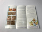 Palomar Lux 1540 Fractional Laser Skin Resurfacing Patient Brochures Pack of 45