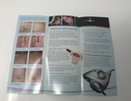 Palomar StarLux IPL Pulsed Light Laser Hair Removal Treatment Patient Brochure