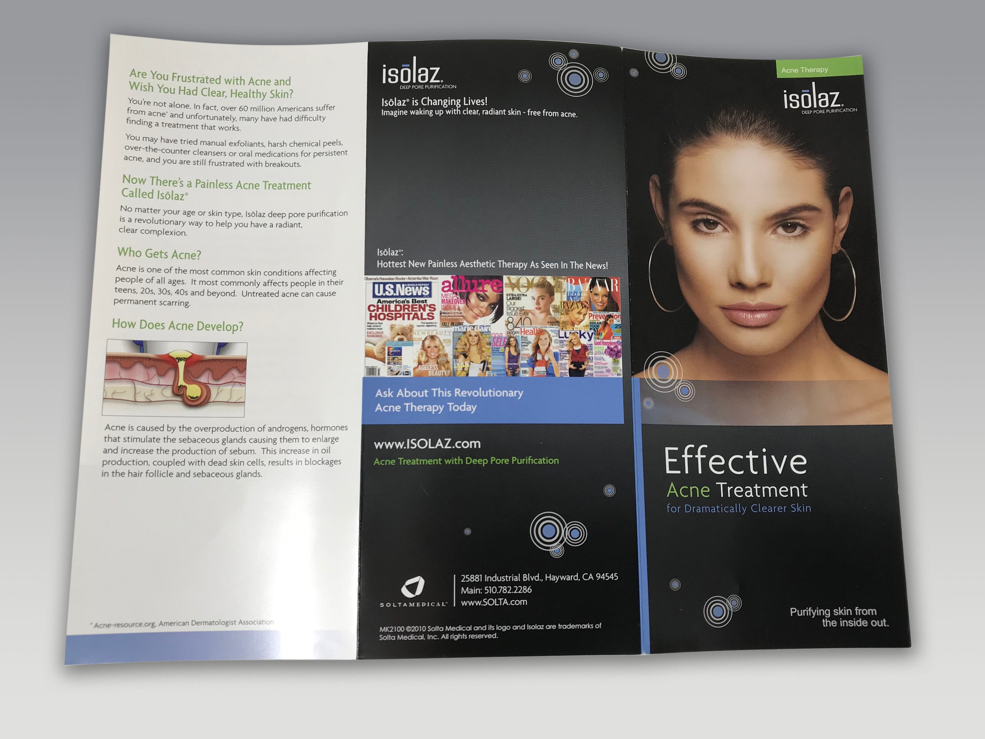 Solta Isolaz Acne Therapy Effective Acne Treatment IPL Patient Brochures 25 pack