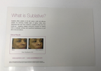 Syneron Candela Sublative Skin Resurfacing Treatment Marketing Flyers Cards