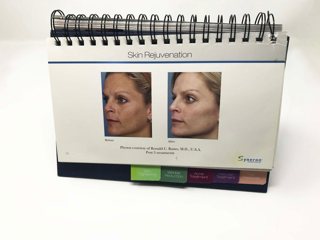 Elos SYNERON Laser Aesthetic IPL Before And After Case Studies Presentation Book