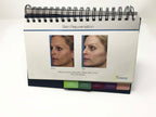 Elos SYNERON Laser Aesthetic IPL Before And After Case Studies Presentation Book