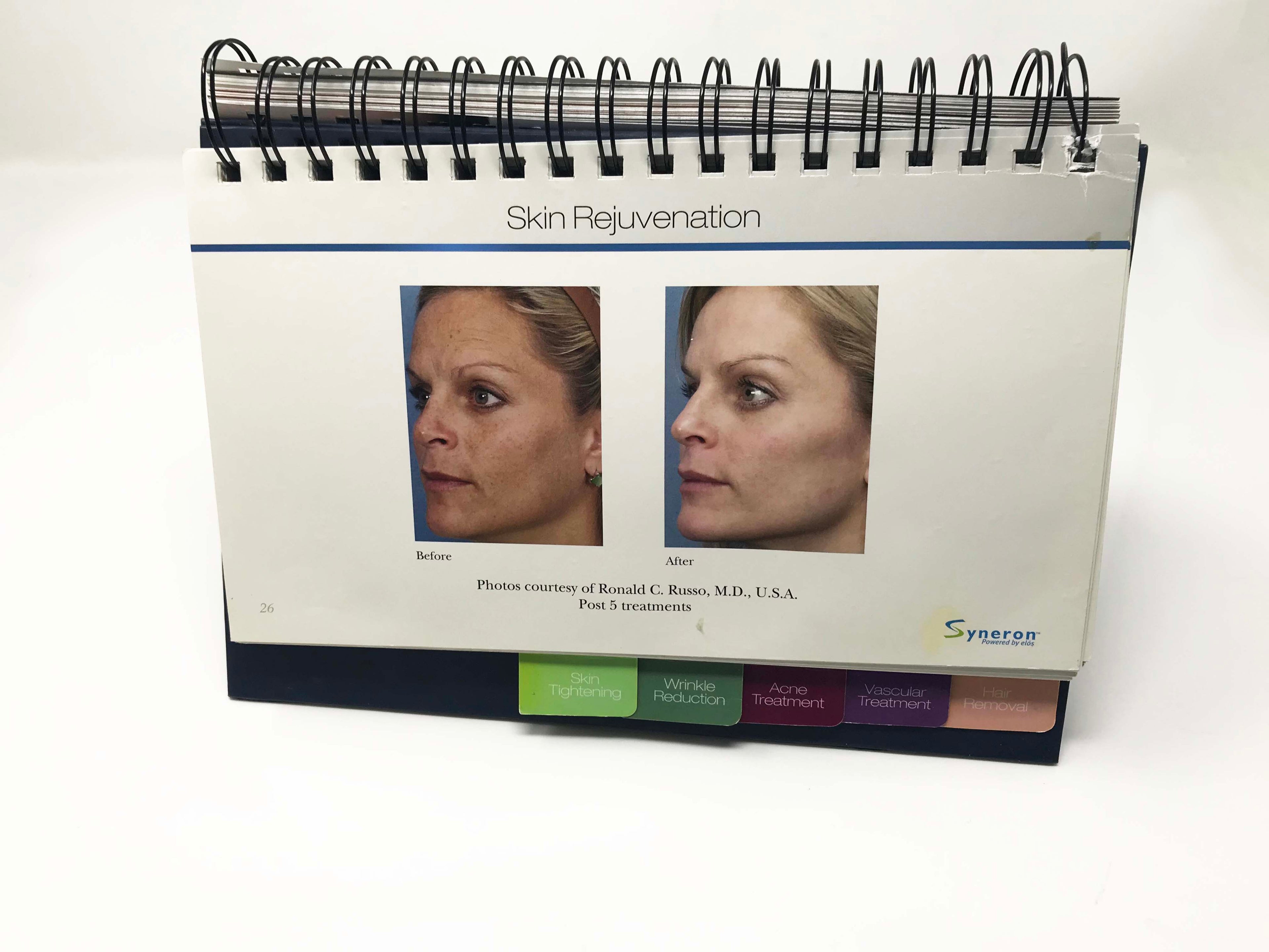 Elos SYNERON Laser Aesthetic IPL Before And After Case Studies Presentation Book
