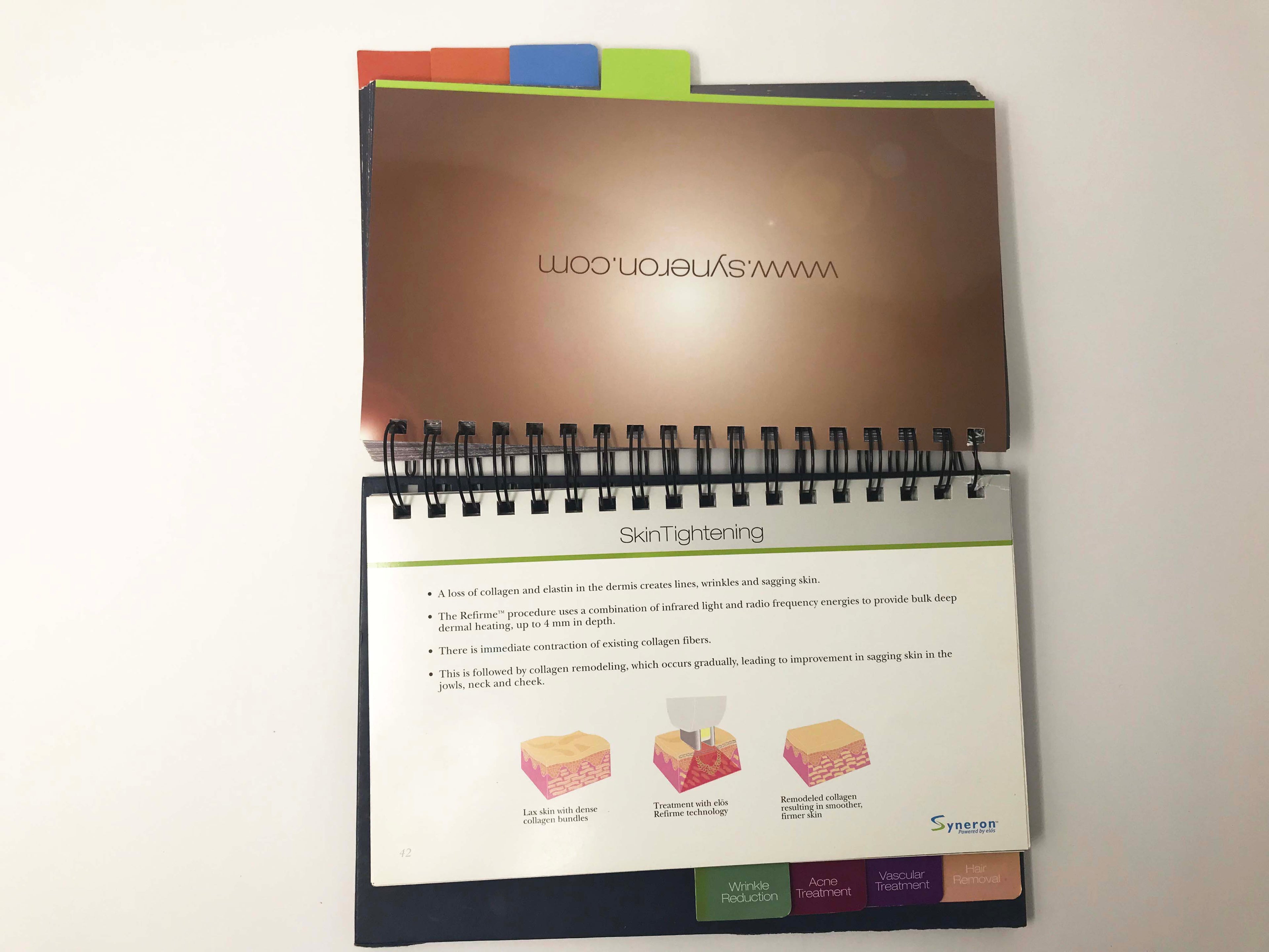 Elos SYNERON Laser Aesthetic IPL Before And After Case Studies Presentation Book