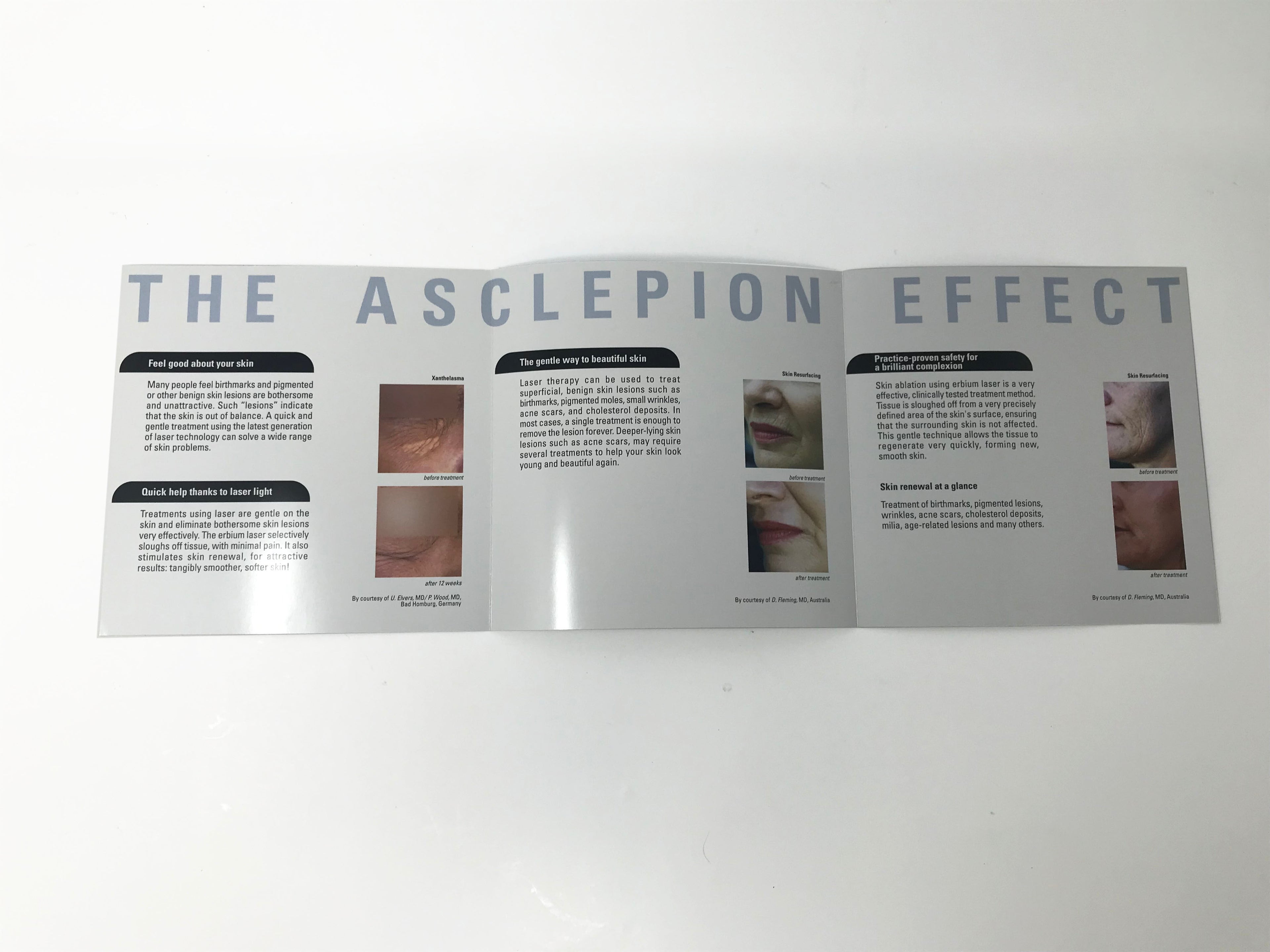 The Asclepion Effect Laser Skin Resurfacing Dermal Lesion Patient Brochures 50CT