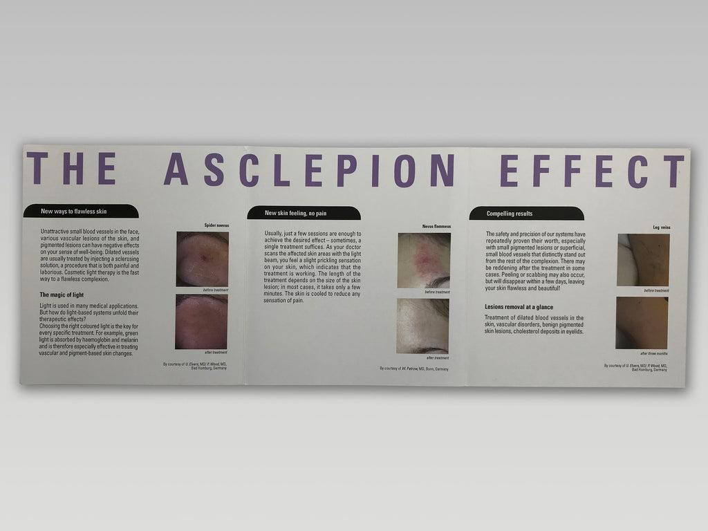 The Asclepion Effect Vascular Lesion Vein Nevus Removal Laser Patient Brochures