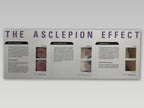 The Asclepion Effect Vascular Lesion Vein Nevus Removal Laser Patient Brochures