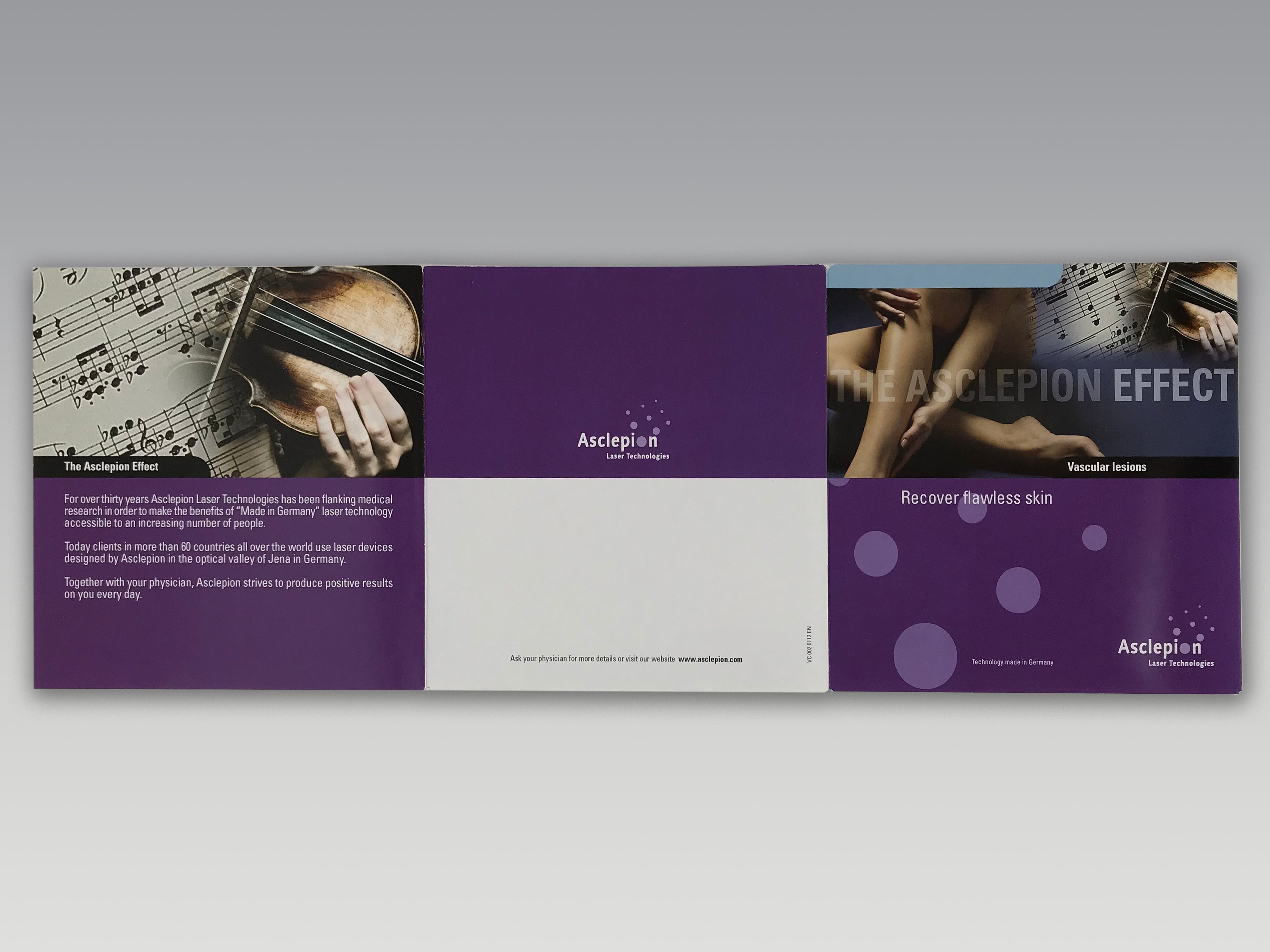The Asclepion Effect Vascular Lesion Vein Nevus Removal Laser Patient Brochures
