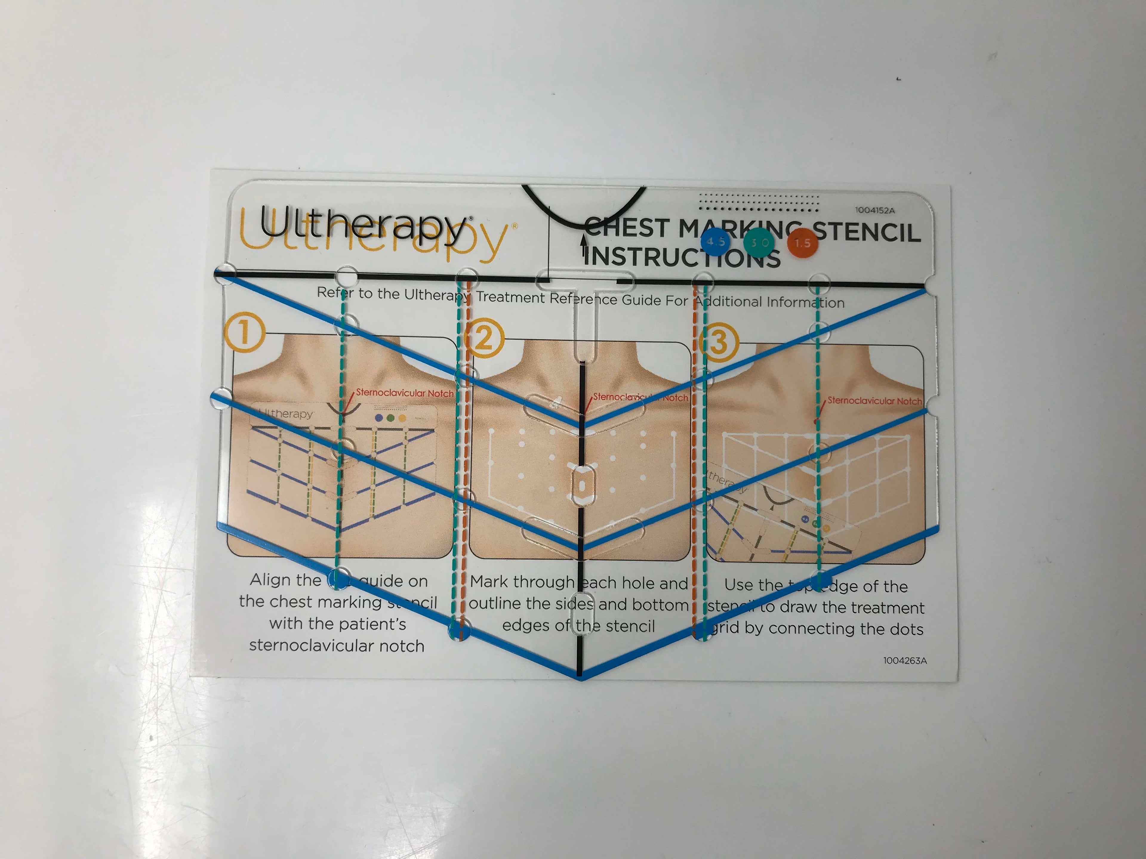 Ulthera Ultherapy Patient Chest Marking Line Stencil Treatment Planning Guide